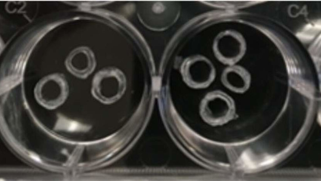 Strontium-loaded scaffold may improve dental implant wound healing