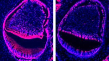 Une découverte génétique pourrait mener à des progrès dans les traitements dentaires