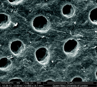 Fig. 8: Open tubules on the dentine surface (research at Queen Mary University of London).