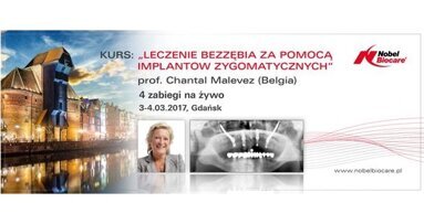 „Leczenie bezzębia za pomocą implantów zygomatycznych” – praktyczny kurs dla lekarzy dentystów