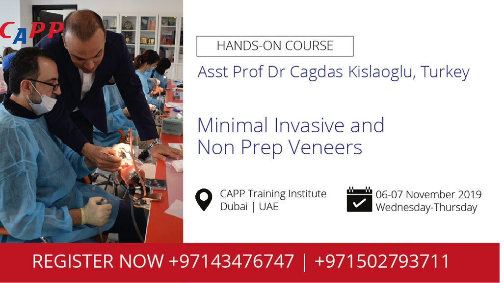 Minimal Invasive and Non Prep Veneers Smart Smile Design with Veneers