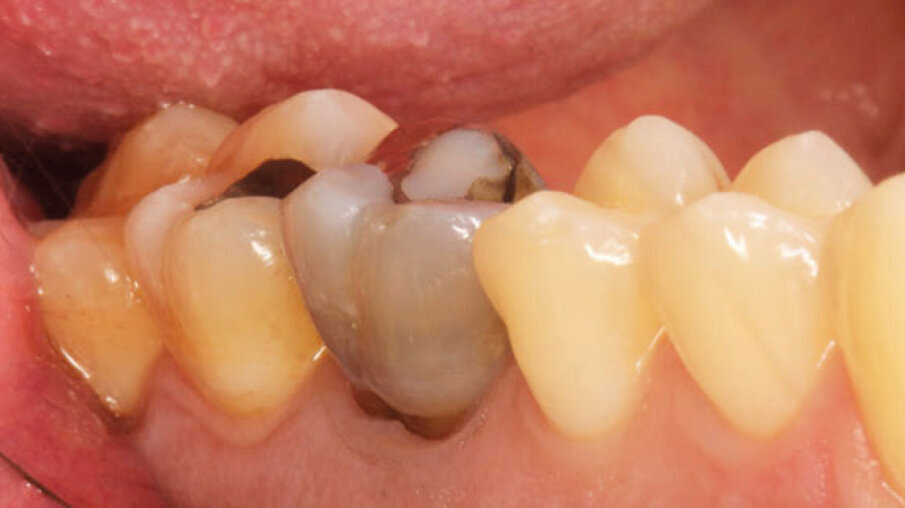 Fig. 1b_Foto iniziale vestibolare. 