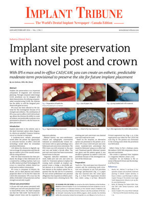Implant Tribune Canada