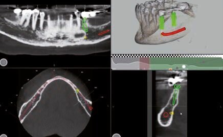 Fig. 5 - Progettazione impianto 37.