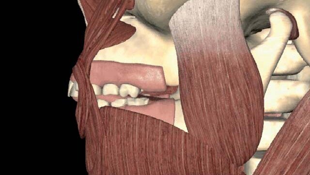 Zaburzenia funkcji stawu skroniowo-żuchwowego a ortodoncja