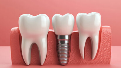 Titan im Fokus: Schweizer Forscherin untersucht Implantat-Grenzflächen