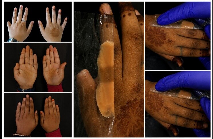 Finger case 