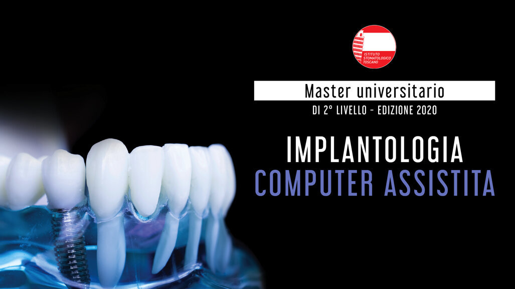 Master 2° livello in implantologia computer assistita 2019/2020