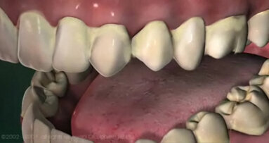 Free web-based patient education software released