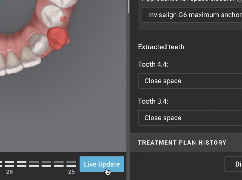 ClinCheck Live Update enables instant visual feedback on tooth movements, improving collaboration and clinical efficiency.