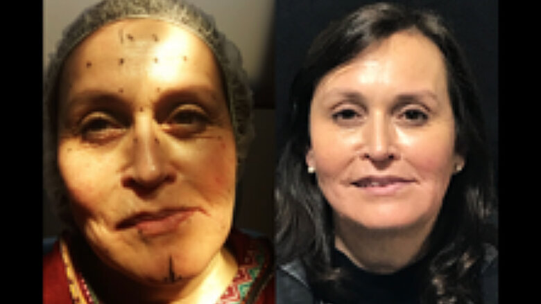 Foto 5. Control día 21 post tratamiento. Paciente relata sentirse muy feliz con los cambios logrados. 
