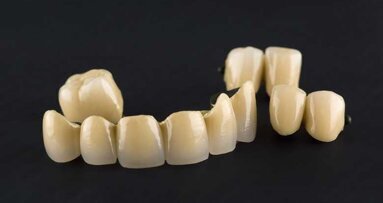 Metalokeramičke krunice su i  dalje “zlatni standard”