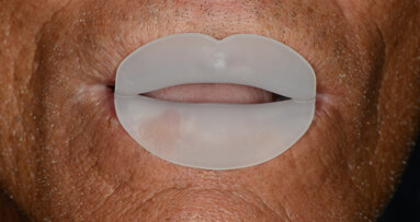 Interdisciplinary rehabilitation involving Froggymouth