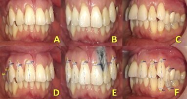 La línea de la belleza del rostro