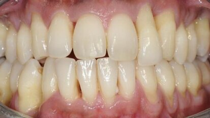 Practical periodontics in daily practice