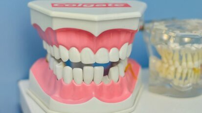 Onderscheid cariës en caviteiten