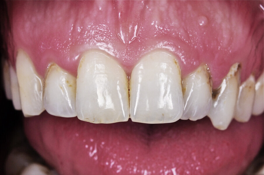 Fig. 17: Original initial situation 9 years ago