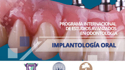Programa Internacional de Estudios Avanzados en Odontología Programa Internacional de Estudios Avanzados en Odontología