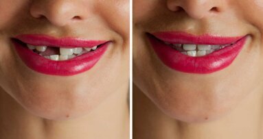 Nachwachsen neuer Zähne durch Medikament