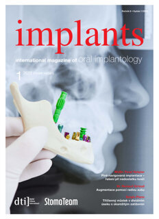 implants-czech-republic-no-1-2022 implants-czech-republic-no-1-2022
