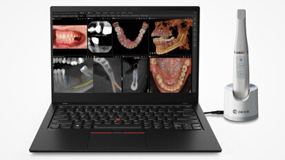 DEXIS Intraoralscanner jetzt mit offener und KI-unterstützter Bildgebungssoftware