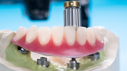 Trends in the US overdenture market