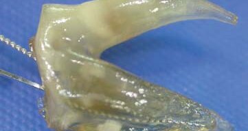 Transparentne zęby – skuteczna pomoc edukacyjna