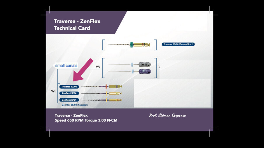 Sl. 5: Sleimanova sekvenca oblikovanja pomoću Traverse i ZenFlex turpija