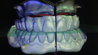 Value chains being transformed by new digital dental technologies