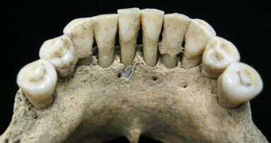 Researchers discover pigments of lapis lazuli in medieval woman’s jaw