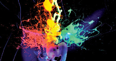 Kompobond: Vývoj nového dentálního výplňového materiálu – část I.