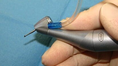 El primer contra-ángulo de 45 grados