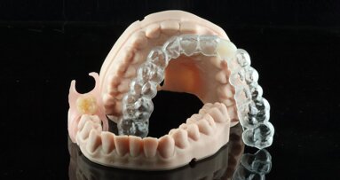 Contemporary provisionalisation with 3D printing: New approaches to familiar clinical challenges