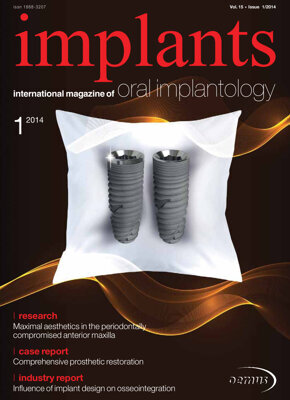 implants international No. 1, 2014 implants international No. 1, 2014