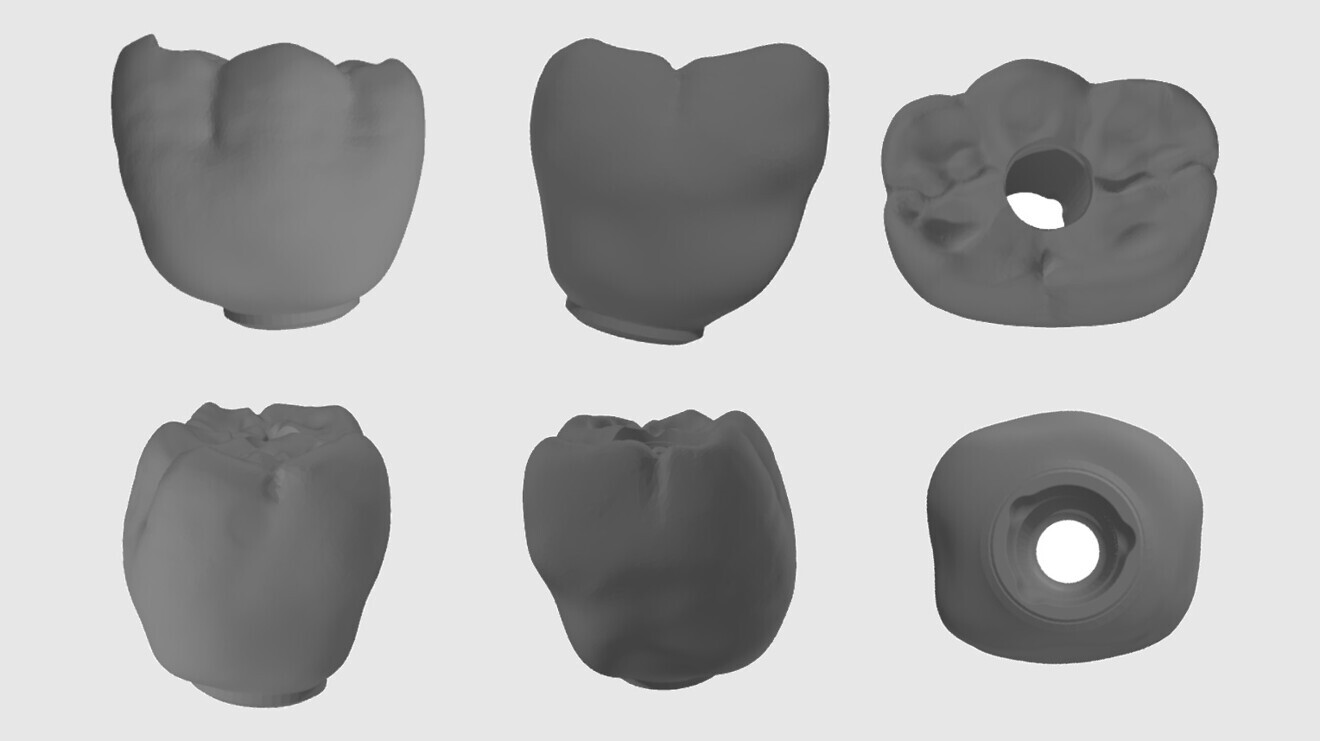 Fig. 4: 3D CAD in STL format.