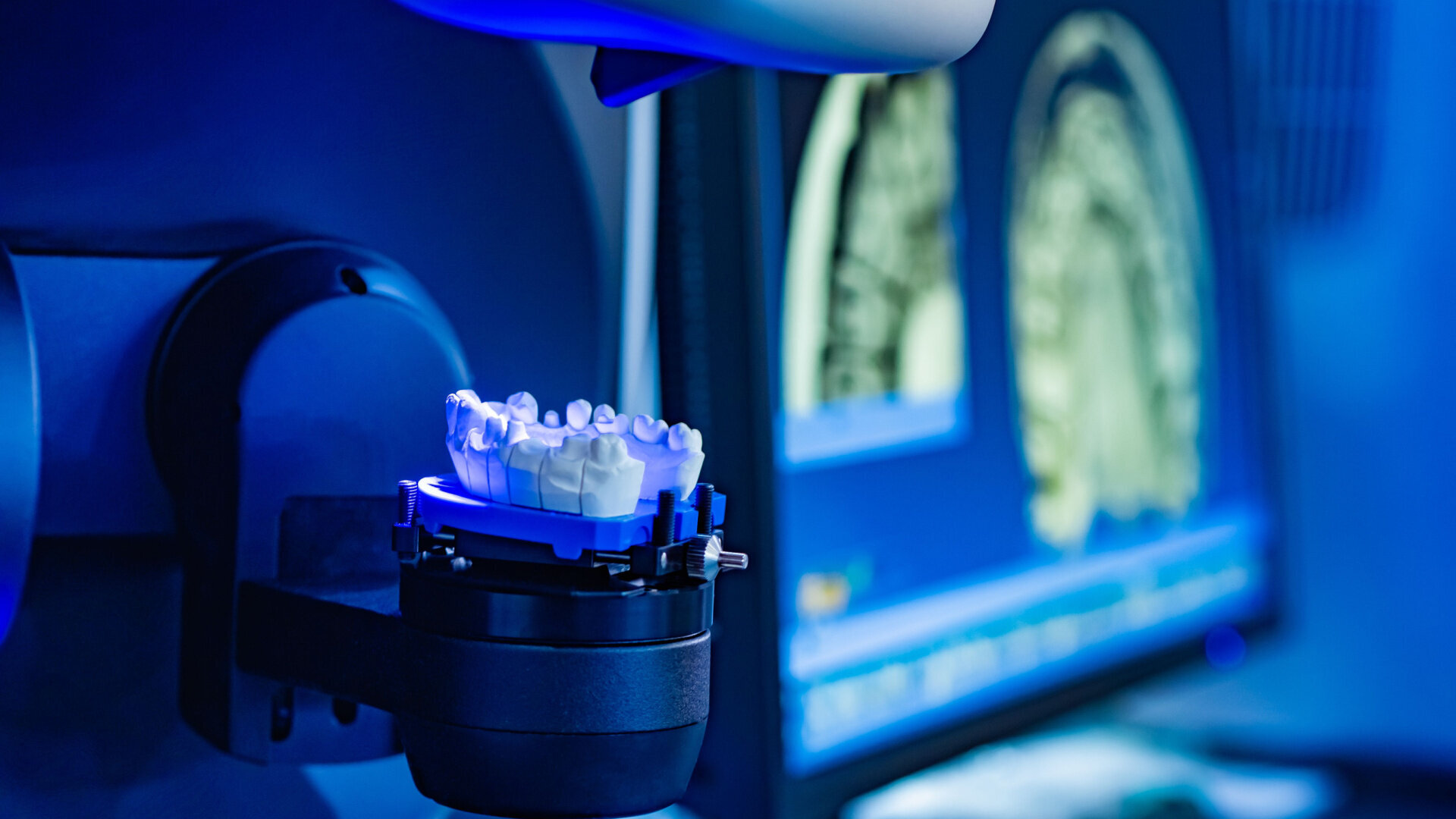 Resurgence and consolidation in Europe’s dental prostheses and digital dentistry markets