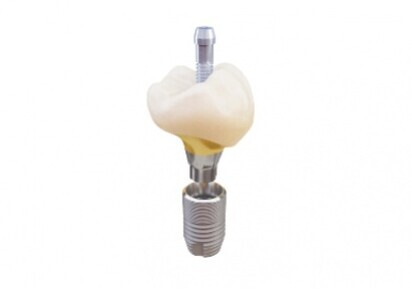 Dentsply Sirona – Atlantis CustomBase