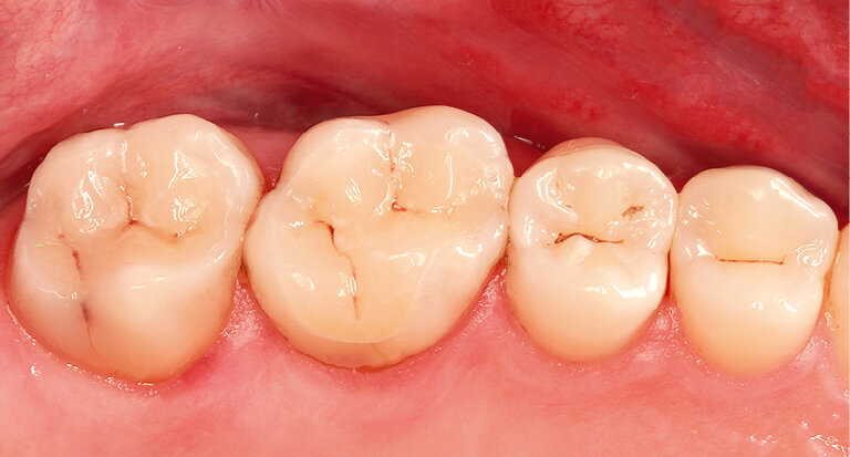 Fig. 14: The final result in 2008: beautiful optical integration