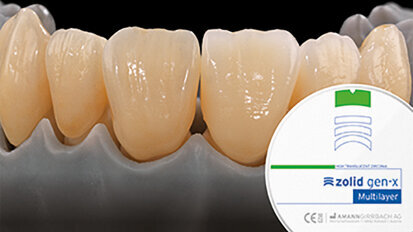 Universal Excellence