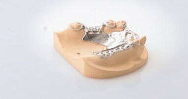 Dentures produced using 3-D printing versus casting and milling