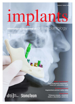 implants Czech Republic No. 1, 2022