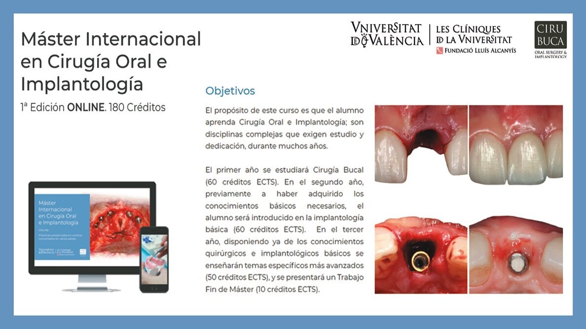 Primer Máster Internacional ONLINE en Cirugía Oral e lmplantología
