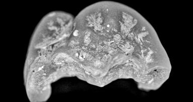 A novel workflow for indirect restorations without digital design