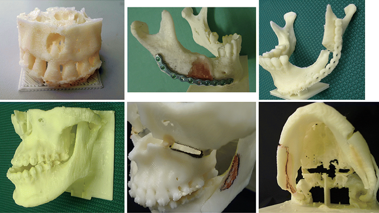 Researchers develop environment for manufacture of inexpensive 3-D dental models
