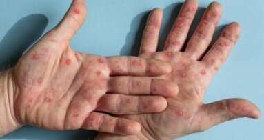 Een praktijk zonder apenpokken