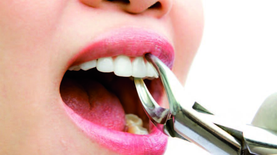 无执照牙医困扰斐济