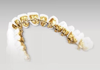 3M Incognito Appliance System