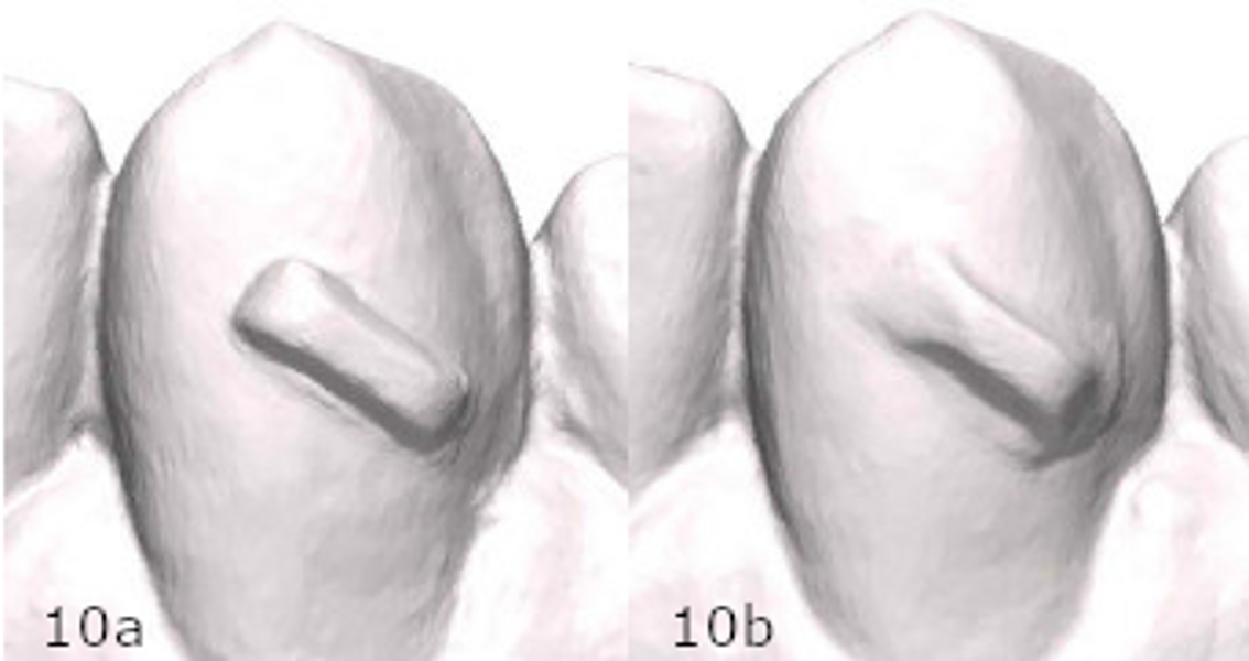 Figs. 10a & b: Scans of individual teeth with bonded attachments. (a) Clarity Precision Grip Attachment and (b) conventionally moulded attachment.