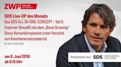 Live-OP am 8. Juni : Das SDS ALL-IN-ONE-CONCEPT – Teil 3 Live-OP am 8. Juni : Das SDS ALL-IN-ONE-CONCEPT – Teil 3