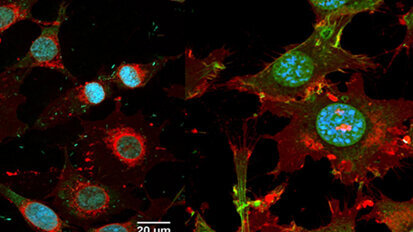 Forscher entwickeln keimreduzierende Implantate